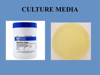 Culture media & its types with examples | PPTX
