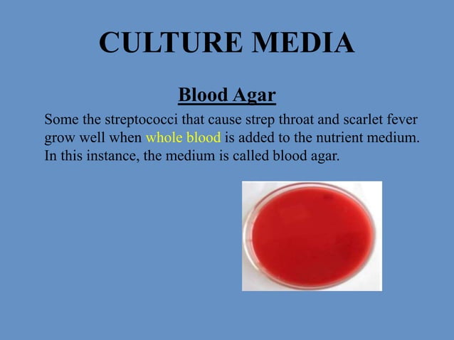 Culture media & its types with examples | PPTX | Nutrition | Healthy Living