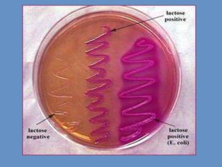 Culture media & its types with examples | PPTX