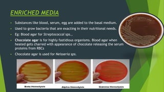 ENRICHED MEDIA
 Substances like blood, serum, egg are added to the basal medium.
 Used to grow bacteria that are exacting in their nutritional needs.
 Eg: Blood agar for Streptococcal sps.,
 Chocolate agar is for highly fastidious organisms. Blood agar when
heated gets charred with appearance of chocolate releasing the serum
proteins from RBCs
 Chocolate agar is used for Neisseria sps.
 