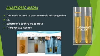 ANAEROBIC MEDIA
 This media is used to grow anaerobic microorgansims
 Eg.
 Robertson’s cooked meat broth
 Thioglycolate Medium THIOGLYCOLATE
MEDIUM
 