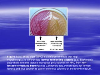 Colorless Colonies Culture Media and culture technique.ppt
