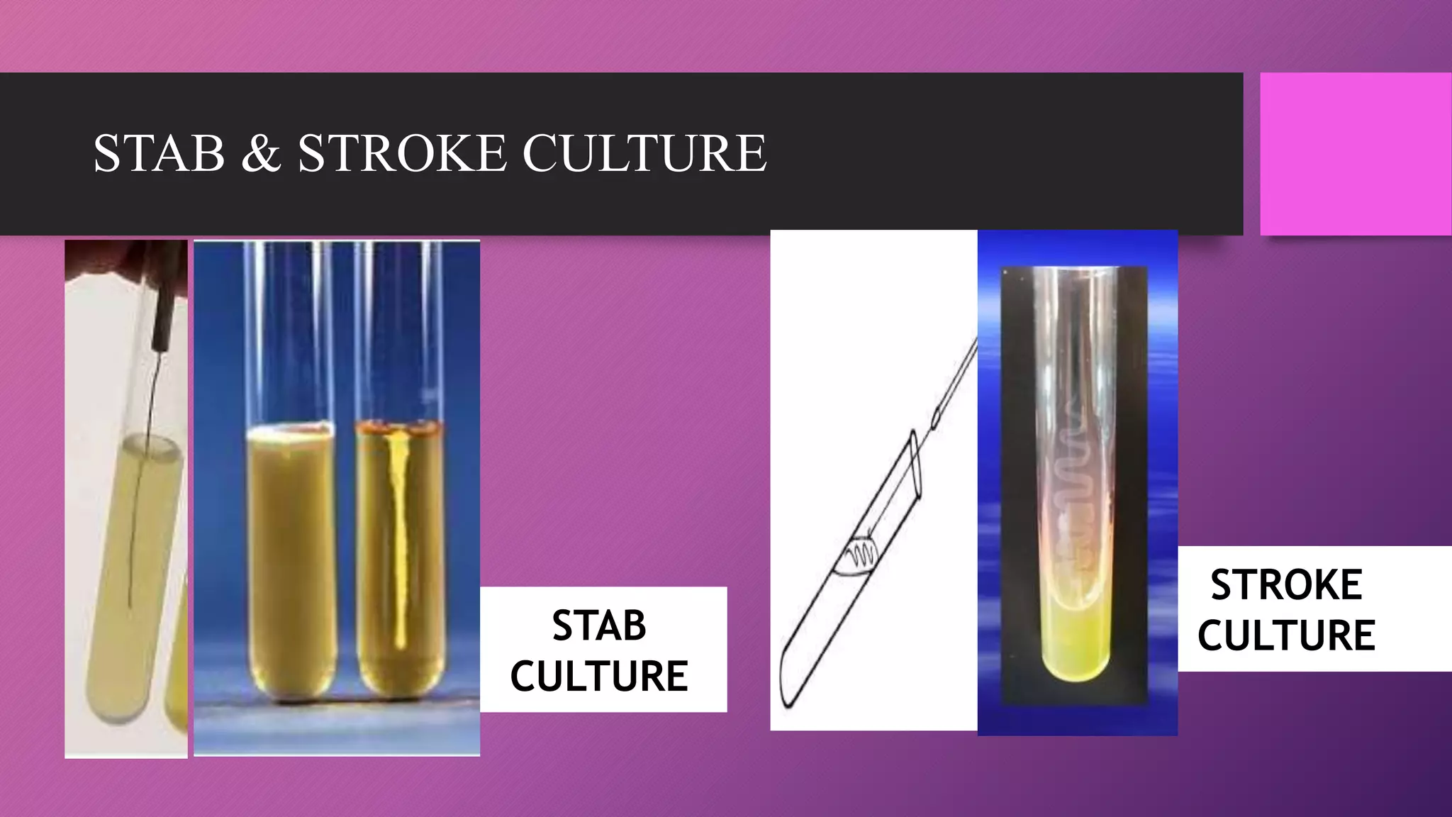 STAB
CULTURE
STROKE
CULTURE
STAB & STROKE CULTURE
 