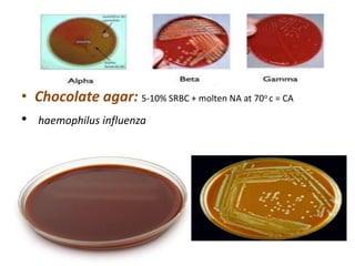 • Chocolate agar: 5-10% SRBC + molten NA at 70o c = CA
• haemophilus influenza
 
