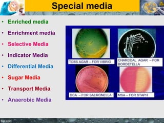 Special media
• Enriched media
• Enrichment media
• Selective Media
• Indicator Media
• Differential Media
• Sugar Media
• Transport Media
• Anaerobic Media
 