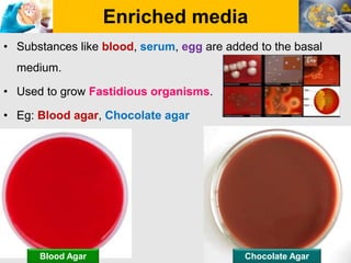 Enriched media
• Substances like blood, serum, egg are added to the basal
medium.
• Used to grow Fastidious organisms.
• Eg: Blood agar, Chocolate agar
Chocolate Agar
Blood Agar
 