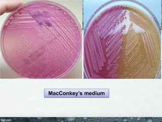 MacConkey’s medium
 
