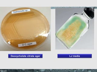 Deoxycholate citrate agar LJ media
 