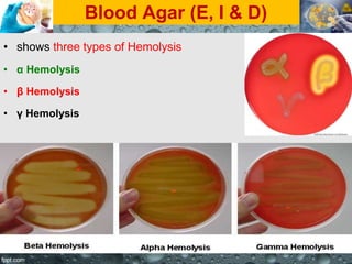 Blood Agar (E, I & D)
• shows three types of Hemolysis
• α Hemolysis
• β Hemolysis
• γ Hemolysis
 