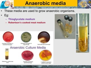 Anaerobic media
• These media are used to grow anaerobic organisms.
• Eg:
– Thioglycolate medium
– Robertson’s cooked meat medium
 