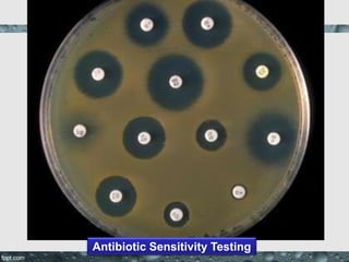 Antibiotic Sensitivity Testing
 