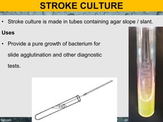 STROKE CULTURE
• Stroke culture is made in tubes containing agar slope / slant.
Uses
• Provide a pure growth of bacterium for
slide agglutination and other diagnostic
tests.
 