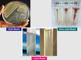 Solid Media
Liquid Media
Semi solid Media
 