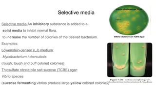 culture media and culture methods mbbs.pptx