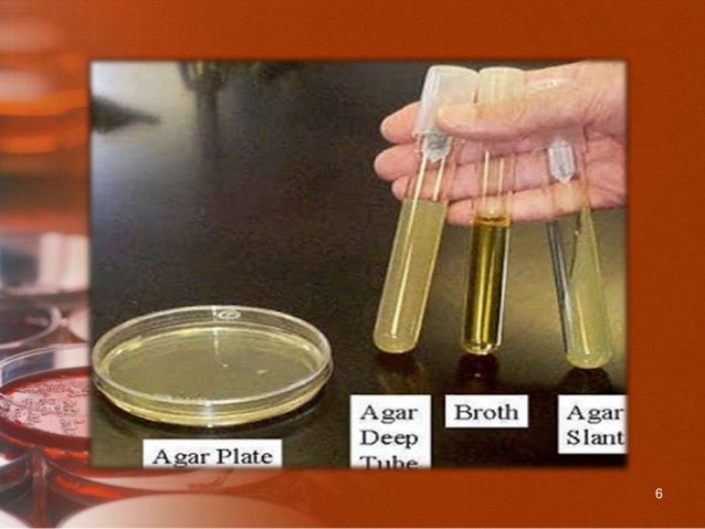 Culture media and methods for mbbs