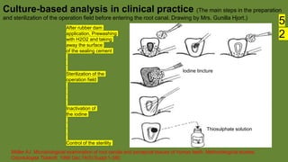 Möller AJ. Microbiological examination of root canals and periapical tissues of human teeth. Methodological studies.
Odontologisk Tidskrift. 1966 Dec;74(5):Suppl:1-380.
Culture-based analysis in clinical practice (The main steps in the preparation
and sterilization of the operation field before entering the root canal. Drawing by Mrs. Gunilla Hjort.)
Iodine tincture
Thiosulphate solution
After rubber dam
application, Prewashing
with H2O2 and taking
away the surface
of the sealing cement
Sterilization of the
operation field
Inactivation of
the iodine
Control of the sterility
5
2
 