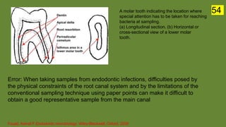 A molar tooth indicating the location where
special attention has to be taken for reaching
bacteria at sampling.
(a) Longitudinal section. (b) Horizontal or
cross-sectional view of a lower molar
tooth.
Fouad, Ashraf F Endodontic microbiology. Wiley-Blackwell, Oxford, 2009
Error: When taking samples from endodontic infections, difficulties posed by
the physical constraints of the root canal system and by the limitations of the
conventional sampling technique using paper points can make it difficult to
obtain a good representative sample from the main canal
54
 