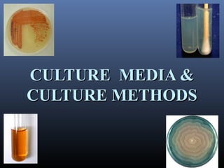 CULTURE MEDIA &CULTURE MEDIA &
CULTURE METHODSCULTURE METHODS
 