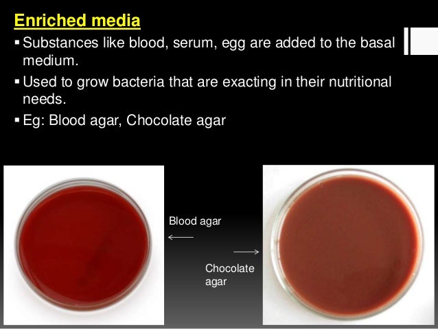 agar of n composition & methods media Culture culture copy