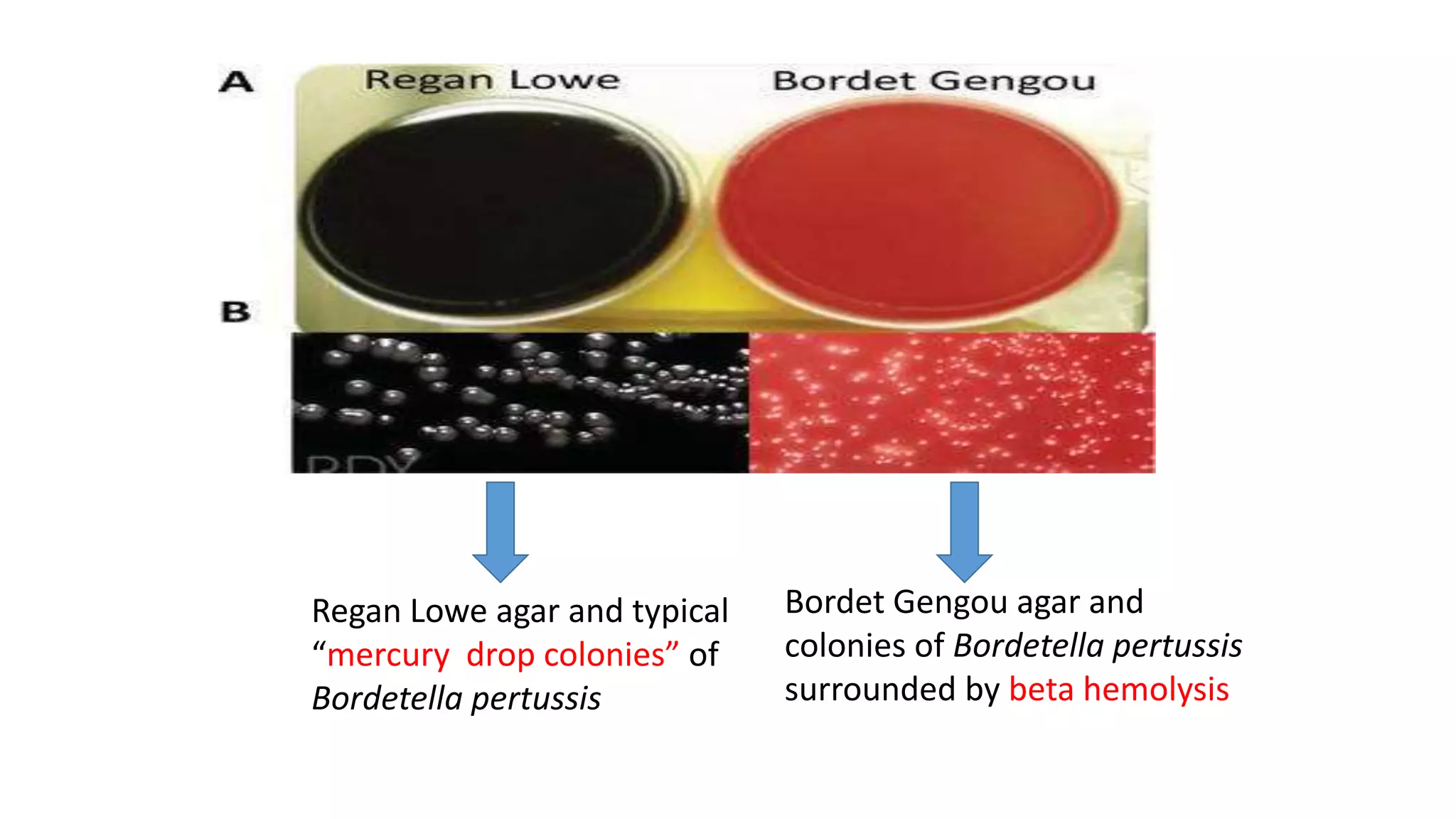 Regan Lowe agar and typical
“mercury drop colonies” of
Bordetella pertussis
Bordet Gengou agar and
colonies of Bordetella pertussis
surrounded by beta hemolysis
 