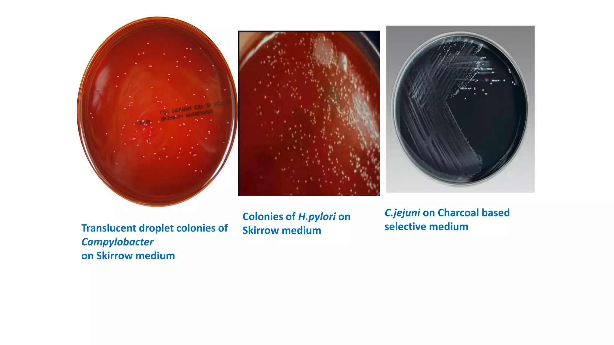 Translucent droplet colonies of
Campylobacter
on Skirrow medium
Colonies of H.pylori on
Skirrow medium
C.jejuni on Charcoal based
selective medium
 