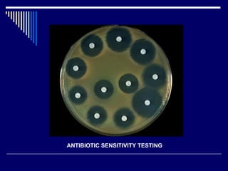 ANTIBIOTIC SENSITIVITY TESTING  