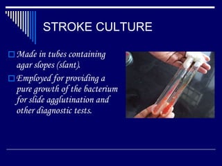 STROKE CULTURE Made in tubes containing agar slopes (slant). Employed for providing a pure growth of the bacterium for slide agglutination and other diagnostic tests. 