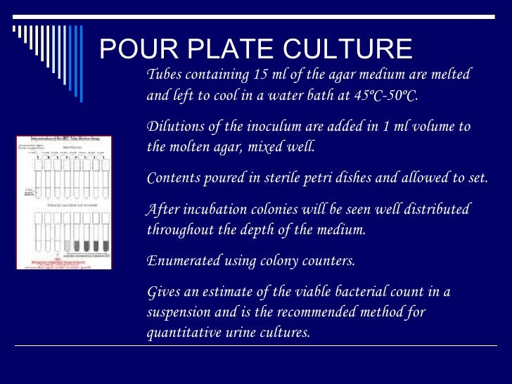 formation urine methods Culture