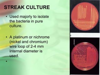 STREAK CULTURE
• Used majorly to isolate
the bacteria in pure
culture.
• A platinum or nichrome
(nickel and chromium)
wire loop of 2-4 mm
internal diameter is
used.
•
 