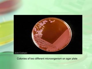 Colonies of two different microorganism on agar plate
 