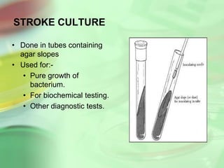 STROKE CULTURE
• Done in tubes containing
agar slopes
• Used for:-
• Pure growth of
bacterium.
• For biochemical testing.
• Other diagnostic tests.
 