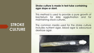 REJO – CAMS, QU
STROKE
CULTURE
Stroke culture is made in test-tube containing
agar slope or slant.
This method is used to provide a pure growth of
bacterium for slide agglutination and for
maintaining stock cultures.
The common media used for the stroke culture
includes nutrient agar, blood agar & sabouraud
dextrose agar.
 