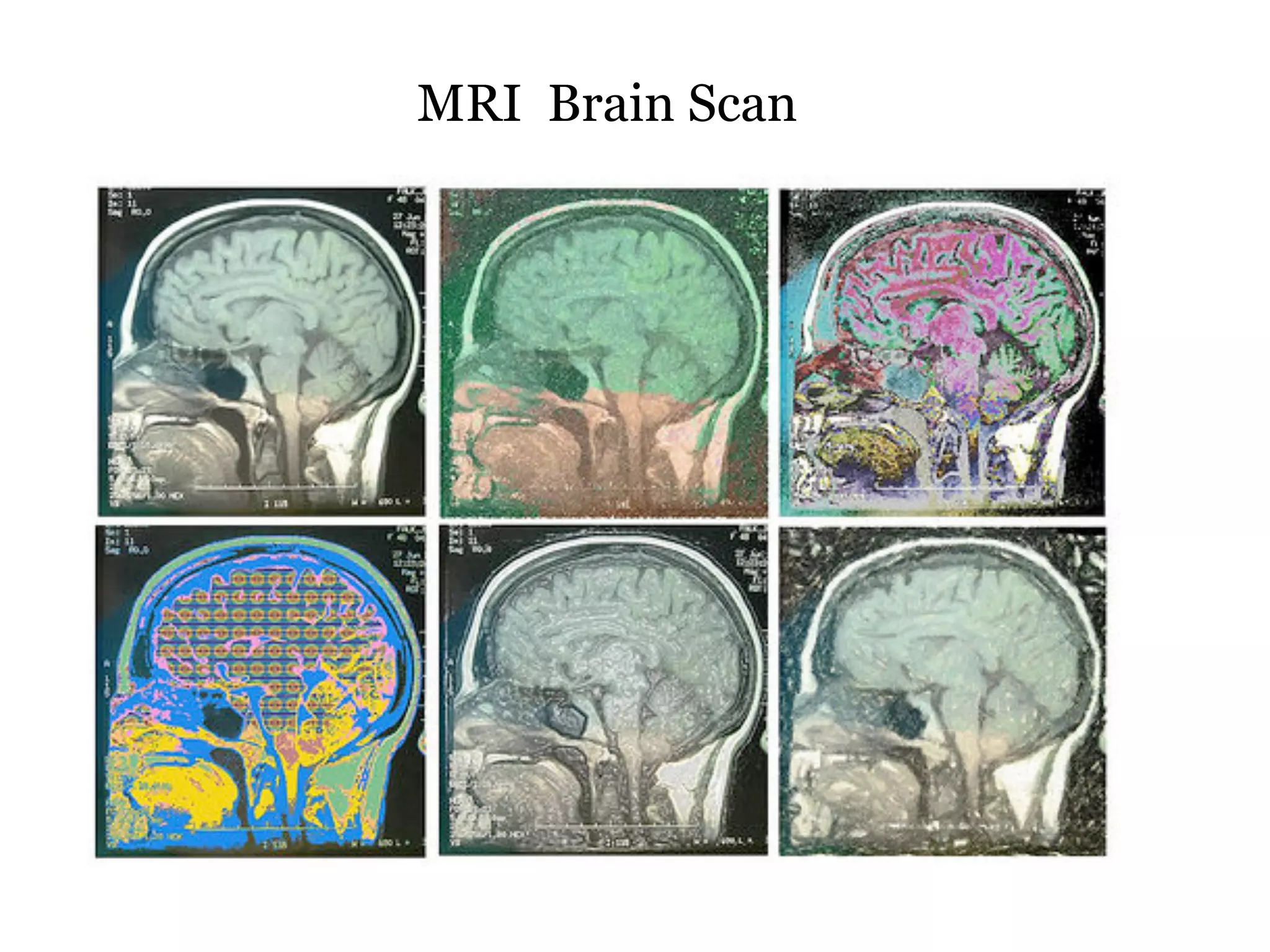 MRI Brain Scan
 