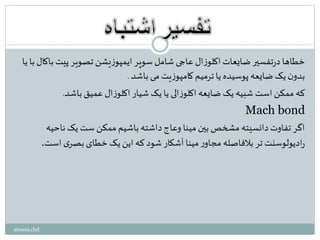 ‫ی‬ ‫با‬ ‫باکال‬ ‫پیت‬ ‫تصویر‬ ‫یشن‬‫ز‬‫ایمپو‬ ‫سوپر‬ ‫شامل‬ ‫عاجی‬ ‫ال‬‫ز‬‫اکلو‬‫ضایعات‬ ‫تفسیر‬‫ر‬‫د‬‫خطاها‬‫ا‬
‫باشد‬ ‫می‬‫یت‬‫ز‬‫کامپو‬ ‫ترمیم‬ ‫یا‬ ‫پوسیده‬ ‫ضایعه‬ ‫یک‬‫ن‬‫بدو‬.
‫باشد‬ ‫عمیق‬ ‫ال‬‫ز‬‫اکلو‬ ‫شیار‬ ‫یک‬ ‫یا‬ ‫الی‬‫ز‬‫اکلو‬ ‫ضایعه‬ ‫یک‬ ‫شبیه‬ ‫است‬‫ممکن‬ ‫که‬.
Mach bond
‫ناحیه‬ ‫یک‬ ‫ست‬ ‫ممکن‬ ‫باشیم‬ ‫داشته‬‫وعاج‬ ‫مینا‬‫بین‬ ‫مشخص‬ ‫دانسیته‬‫تفاوت‬ ‫اگر‬
‫است‬‫ی‬‫بصر‬ ‫خطای‬ ‫یک‬‫این‬ ‫که‬‫شود‬ ‫آشکار‬ ‫مینا‬‫ر‬‫مجاو‬ ‫بالفاصله‬ ‫تر‬ ‫ادیولوسنت‬‫ر‬.
atousa.chd
 