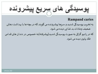 Rampand caries
‫به‬‫با‬ ‫ها‬ ‫بچه‬ ‫در‬ ‫که‬ ‫گویند‬ ‫می‬‫نده‬‫و‬‫پیشر‬ ‫سریعا‬ ‫و‬ ‫شدید‬ ‫پوسیدگی‬‫تخریب‬ ‫به‬‫دهانی‬ ‫داشت‬
‫شود‬ ‫می‬‫دیده‬ ‫غذایی‬‫بد‬‫وعادات‬ ‫ضعیف‬.
‫شدید‬ ‫پوسیدگی‬ ‫ت‬‫ر‬‫صو‬ ‫به‬ ‫افی‬‫ر‬‫گ‬ ‫ادیو‬‫ر‬‫در‬ ‫که‬(‫پیشرفته‬)‫دندان‬ ‫در‬ ‫خصوص‬ ‫به‬‫قدامی‬ ‫های‬
‫شود‬ ‫می‬‫دیده‬ ‫پایین‬ ‫فک‬.
atousa.chd
 