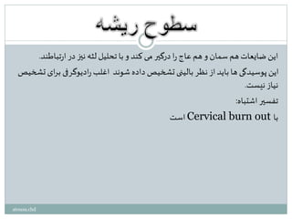 ‫تباطند‬‫ر‬‫ا‬‫در‬ ‫نیز‬ ‫لثه‬ ‫تحلیل‬ ‫با‬‫و‬ ‫کند‬ ‫می‬ ‫درگیر‬ ‫ا‬‫ر‬ ‫عاج‬‫هم‬‫و‬ ‫سمان‬ ‫هم‬ ‫ضایعات‬ ‫این‬.
‫تشخی‬ ‫ای‬‫ر‬‫ب‬ ‫ادیوگرفی‬‫ر‬ ‫اغلب‬ ‫شوند‬‫داده‬ ‫تشخیص‬ ‫بالینی‬ ‫نظر‬ ‫از‬ ‫باید‬ ‫ها‬ ‫پوسیدگی‬ ‫این‬‫ص‬
‫نیست‬ ‫نیاز‬.
‫اشتباه‬ ‫تفسیر‬:
‫است‬ Cervical burn out ‫با‬
atousa.chd
 