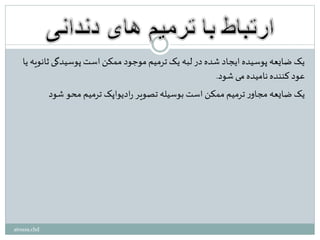 ‫یا‬ ‫ثانویه‬ ‫پوسیدگی‬ ‫است‬‫ممکن‬ ‫موجود‬ ‫ترمیم‬ ‫یک‬ ‫لبه‬‫در‬ ‫شده‬ ‫ایجاد‬ ‫پوسیده‬ ‫ضایعه‬ ‫یک‬
‫شود‬ ‫می‬ ‫نامیده‬ ‫کننده‬ ‫عود‬.
‫شود‬ ‫محو‬ ‫ترمیم‬ ‫ادیواپک‬‫ر‬ ‫تصویر‬ ‫بوسیله‬ ‫است‬‫ممکن‬‫ترمیم‬‫ر‬‫مجاو‬ ‫ضایعه‬ ‫یک‬
atousa.chd
 