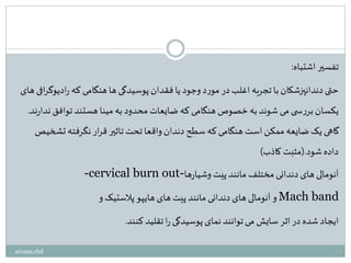 ‫اشتباه‬ ‫تفسیر‬:
‫های‬‫افی‬‫ر‬‫ادیوگ‬‫ر‬ ‫که‬ ‫هنگامی‬‫ها‬‫پوسیدگی‬‫فقدان‬‫یا‬ ‫وجود‬‫د‬‫ر‬‫مو‬ ‫در‬ ‫اغلب‬ ‫تجربه‬‫با‬‫دندانپزشکان‬ ‫حتی‬
‫ند‬‫ر‬‫ندا‬‫توافق‬ ‫هستند‬ ‫مینا‬ ‫به‬ ‫محدود‬ ‫ضایعات‬ ‫که‬ ‫هنگامی‬ ‫خصوص‬‫به‬‫شوند‬ ‫می‬ ‫ی‬ ‫س‬‫ر‬‫بر‬‫یکسان‬.
‫تشخیص‬ ‫نگرفته‬ ‫ار‬‫ر‬‫ق‬ ‫تاثیر‬ ‫تحت‬ ‫واقعا‬‫دندان‬ ‫سطح‬ ‫که‬ ‫هنگامی‬ ‫است‬ ‫ممکن‬ ‫ضایعه‬‫یک‬ ‫گاهی‬
‫شود‬‫داده‬(.‫کاذب‬ ‫مثبت‬)
-cervical burn out-‫ها‬‫ر‬‫وشیا‬ ‫پیت‬‫مانند‬ ‫مختلف‬ ‫دندانی‬ ‫های‬ ‫آنومالی‬
‫و‬‫پالستیک‬ ‫هایپو‬ ‫های‬ ‫پیت‬‫مانند‬ ‫دندانی‬ ‫های‬ ‫آنومالی‬‫و‬ Mach band
‫کنند‬‫تقلید‬‫ا‬‫ر‬ ‫پوسیدگی‬ ‫نمای‬‫توانند‬‫می‬ ‫سایش‬‫اثر‬ ‫در‬ ‫شده‬‫ایجاد‬.
atousa.chd
 