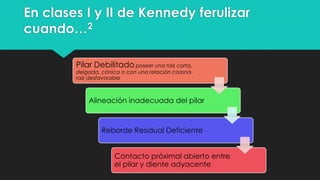 En clases I y II de Kennedy ferulizar
cuando…2
Pilar Debilitado poseer una raíz corta,
delgada, cónica o con una relación corona-
raíz desfavorable
Alineación inadecuada del pilar
Reborde Residual Deficiente
Contacto próximal abierto entre
el pilar y diente adyacente
 