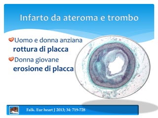 Uomo e donna anziana 
rottura di placca 
Donna giovane 
erosione di placca 
Falk. Eur heart J 2013; 34: 719-728 
 