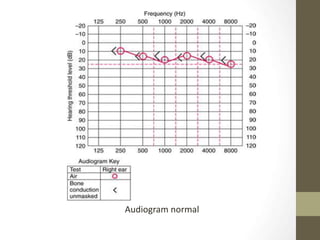 cupdf.com_audiometri-tht1.ppt
