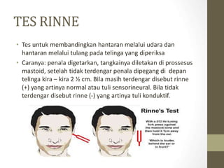 Tes Rinne cupdf.com_audiometri-tht1.ppt