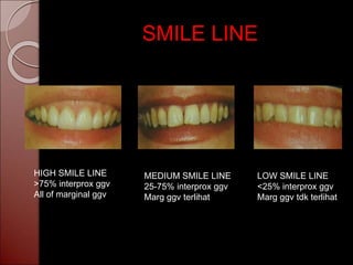 cupdf.com_surgical-crown-lengthening.ppt