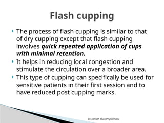 Dr. Azmath Khan Physiomatix
 The process of flash cupping is similar to that
of dry cupping except that flash cupping
involves quick repeated application of cups
with minimal retention.
 It helps in reducing local congestion and
stimulate the circulation over a broader area.
 This type of cupping can specifically be used for
sensitive patients in their first session and to
have reduced post cupping marks.
Flash cupping
 