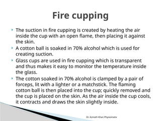Dr. Azmath Khan Physiomatix
 The suction in fire cupping is created by heating the air
inside the cup with an open flame, then placing it against
the skin.
 A cotton ball is soaked in 70% alcohol which is used for
creating suction.
 Glass cups are used in fire cupping which is transparent
and thus makes it easy to monitor the temperature inside
the glass.
 The cotton soaked in 70% alcohol is clamped by a pair of
forceps, lit with a lighter or a matchstick. The flaming
cotton ball is then placed into the cup; quickly removed and
the cup is placed on the skin. As the air inside the cup cools,
it contracts and draws the skin slightly inside.
Fire cupping
 