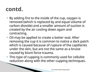 Dr. Azmath Khan Physiomatix
 By adding fire to the inside of the cup, oxygen is
removed (which is replaced by and equal volume of
carbon dioxide) and a smaller amount of suction is
created by the air cooling down again and
contracting.
 Oil may be applied to create a better seal. After
removing the cup it is common to notice a dark patch
which is caused because of rupture of the capillaries
under the skin, but are not the same as a bruise
caused by blunt force trauma.
 This type of cupping is commonly used for cellulite
reduction along with the other cupping techniques.
contd.
 