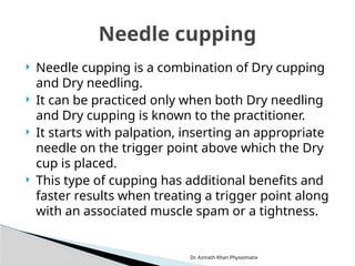 Dr. Azmath Khan Physiomatix
 Needle cupping is a combination of Dry cupping
and Dry needling.
 It can be practiced only when both Dry needling
and Dry cupping is known to the practitioner.
 It starts with palpation, inserting an appropriate
needle on the trigger point above which the Dry
cup is placed.
 This type of cupping has additional benefits and
faster results when treating a trigger point along
with an associated muscle spam or a tightness.
Needle cupping
 
