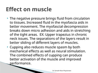 Dr. Azmath Khan Physiomatix
 The negative pressure brings fluid from circulation
to tissues. Increased fluid in the myofascia aids in
better movement. The myofascial decompression
breaks down micro adhesion and aids in stretching
of the tight areas. EX: Upper trapezius in chronic
neck issues. The separations of the layers result in
better sliding of different layers of muscles.
 Cupping also reduces muscle spasm by both
mechanical effects as well as neural stimulation.
The combined effects of cupping can produce
better activation of the muscle and improved
performance.
Effect on muscle
 