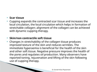 Dr. Azmath Khan Physiomatix
 Scar tissue
 Cupping expands the contracted scar tissue and increases the
local circulation, the local circulation which helps in formation of
stretchable collagen; alignment of the collagen can be achieved
with dynamic cupping therapy.
 Skin/non contractile soft tissue
 Changes in stretchability of the collagen tissue produces
improved texture of the skin and reduces wrinkles. The
immediate hyperaemia is beneficial for the health of the skin
and other soft tissue. Negative pressure improves the health of
the pores and regulates oil production. Many observers have
reported toning, rejuvenation and lifting of the skin following
use of cupping therapy.
 