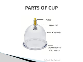 Dr. Azmath Khan Physiomatix
PARTS OF CUP
 